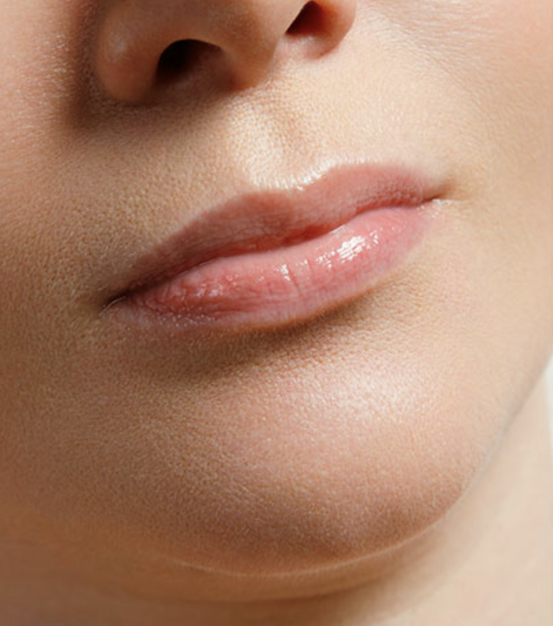Before lip enhancement treatment Manhattan medical spa - natural lip shape